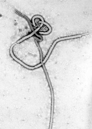 Ebola_virus_em